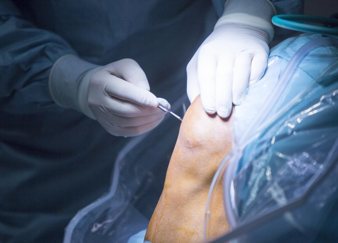 chiropractor/orthopedic surgeon on a lien in Los Angeles