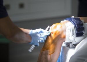 chiropractor/orthopedic surgeon on a lien in Los Angeles